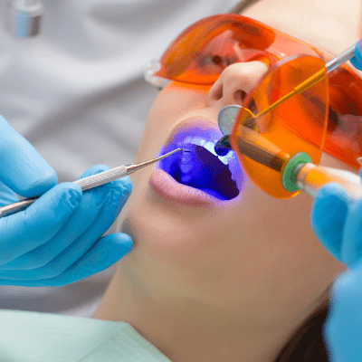 LED Teeth Whitening